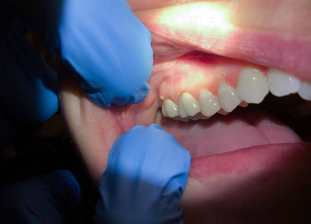 Best Pediatric Emergency Dentist in Richfield, OH